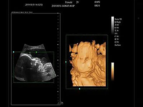 3D/4D-визуализация при использовании объёмных датчиков